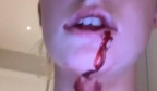 女友控诉遭到格林伍德殴打，嘴角流血、身上有多处淤青
